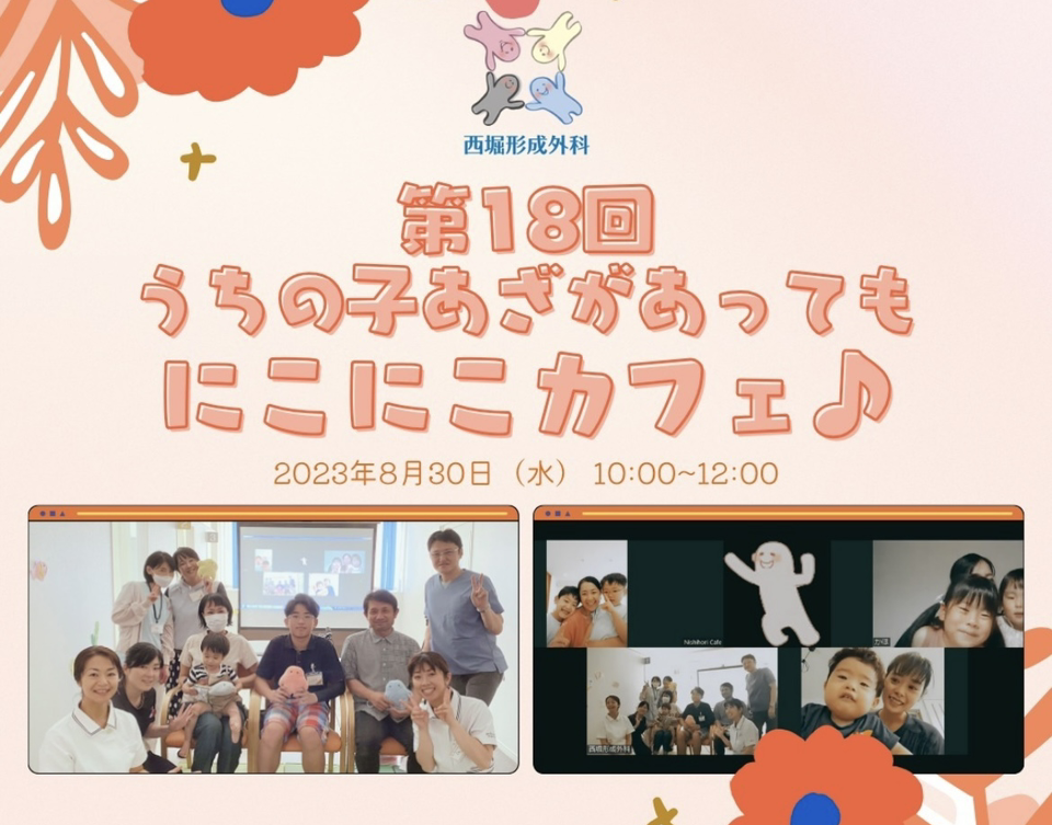 第18回「うちの子にあざがあってもにこにこカフェ」を開催しました♪