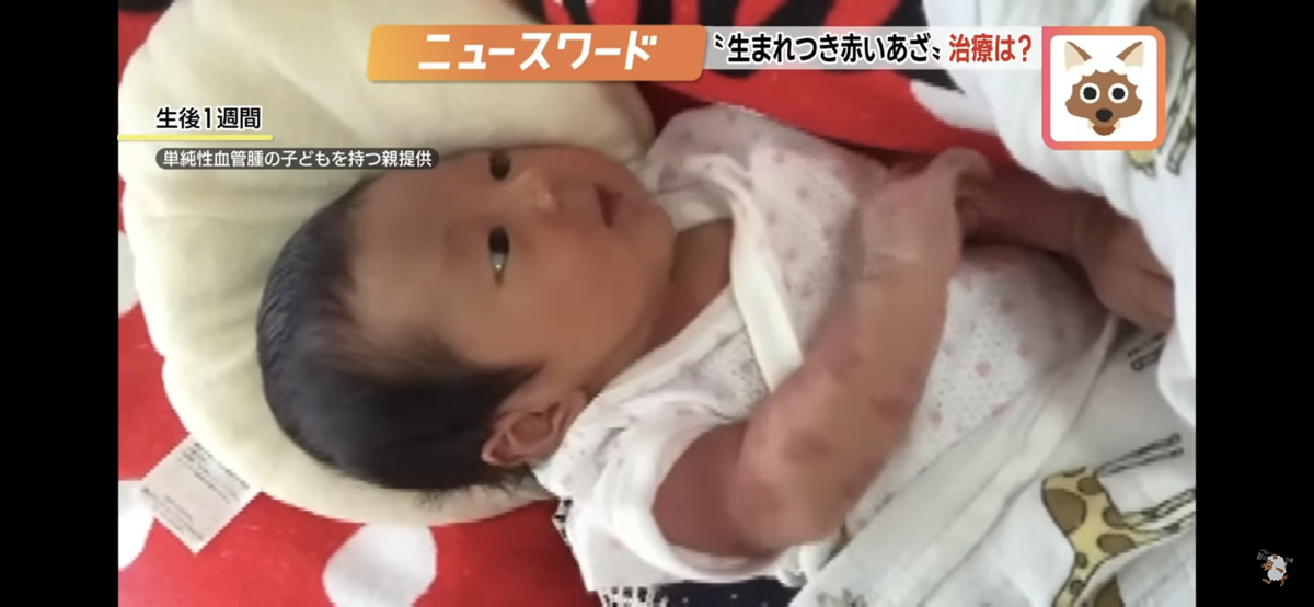 TV取材を受けました