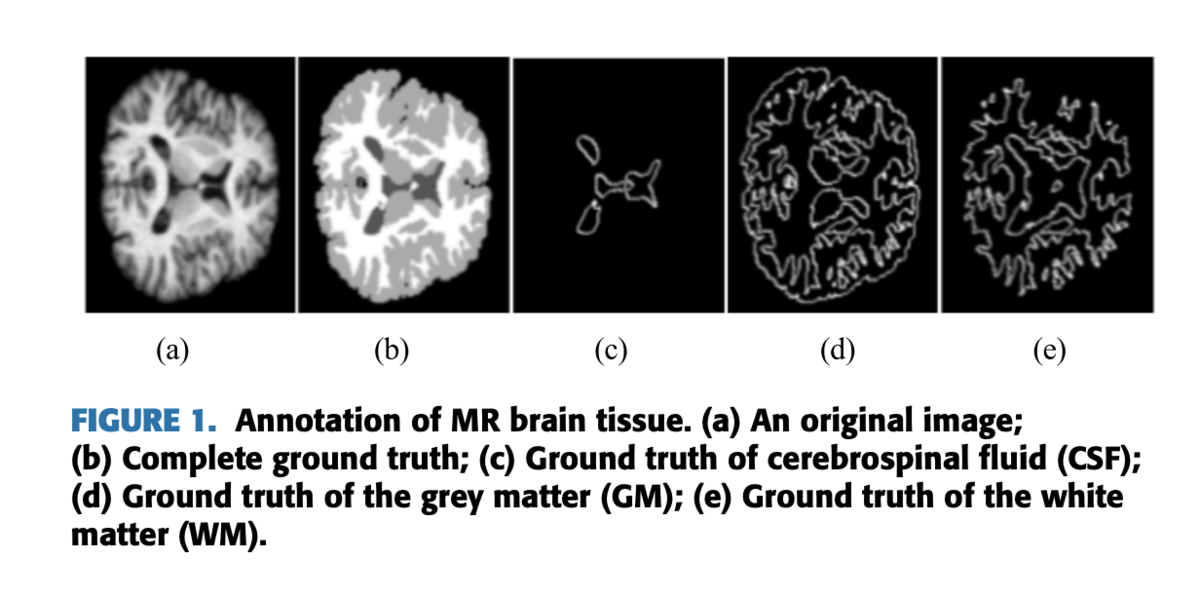 Abeja Tech Blog更新 画像データに対するactive Learningの現状と今後の展望 最新の教師なし学習を添えて 株式会社abeja