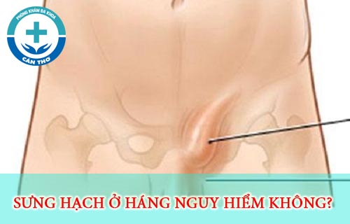Cách trị nổi hạch ở háng hiệu quả nhất là gì? chữa ở đâu tốt