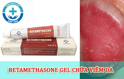 Thuốc Betamethason Gel 30g chữa viêm da