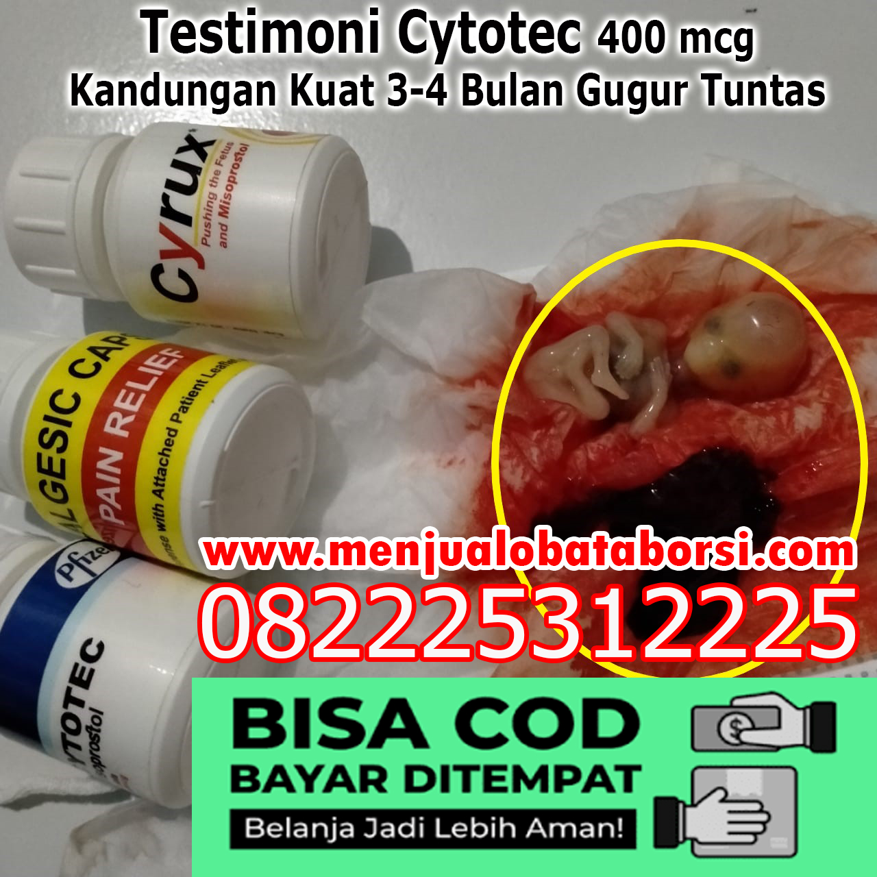 Obat Penggugur Kandungan Alodokter Rekomendasi Obat Aborsi Cytotec ...