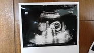 7月に産まれた子供のエコー写真です！この時点でかわいいですね（親ばかでしょうか笑）