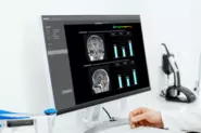 「脳画像解析プログラムBraineer（ブレイニア）」が認知症診断を支援するソフトウェアとして薬事認可を取得