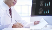 頭部MRIデータより脳の萎縮を定量・数値化し、臨床現場での医師の診断をサポートする医療機器プログラム等などがあります。