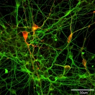 ヒトiPS細胞から誘導したドーパミン産生神経細胞