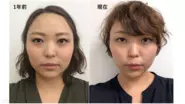 60万人以上の女性のお顔を変えてきました。