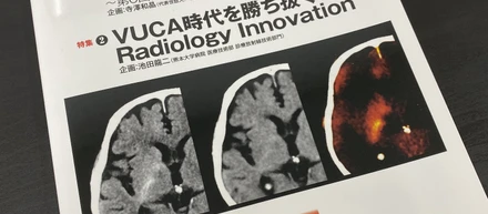 【メディア掲載】雑誌「Rad Fan」に掲載されました