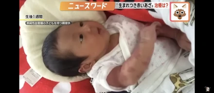 TV取材を受けました