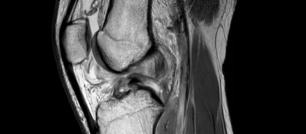 Kaggleコンペティション「RSNA Knee Abnormality Detection」にて、Rist Kaggle Teamメンバーが1位を獲得しました！