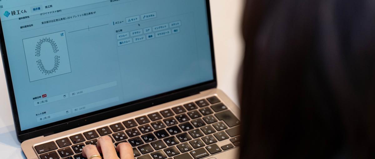 顧客に伴走し、レガシー業界のDXを推進！歯科技工DXのカスタマーサクセス