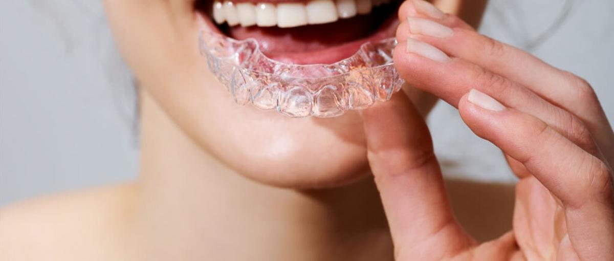 データ分析をもとにヘルスケア事業の推進経験が積める！長期インターンを募集！