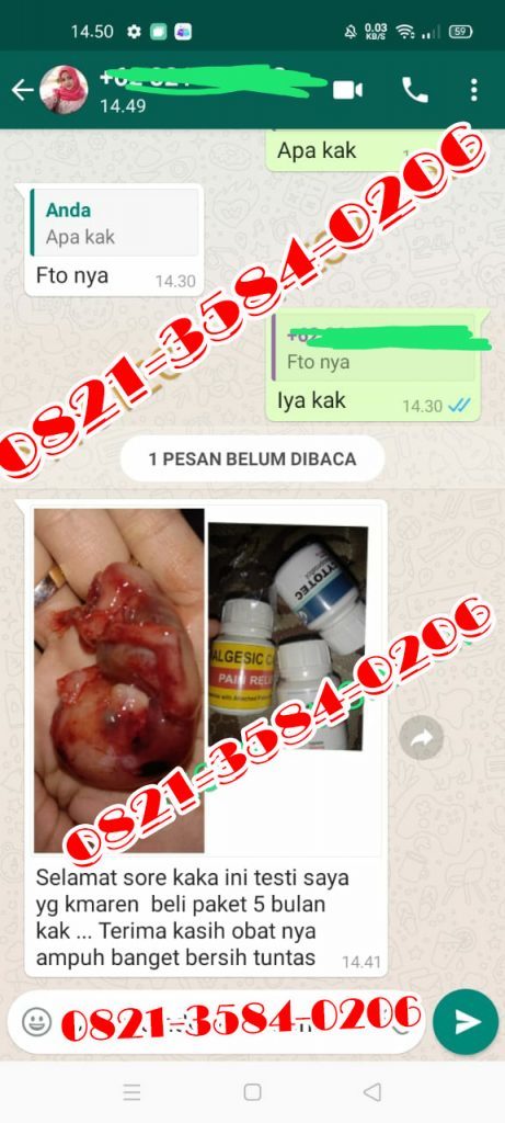 Cara Gugurkan Kandungan 2 Hari