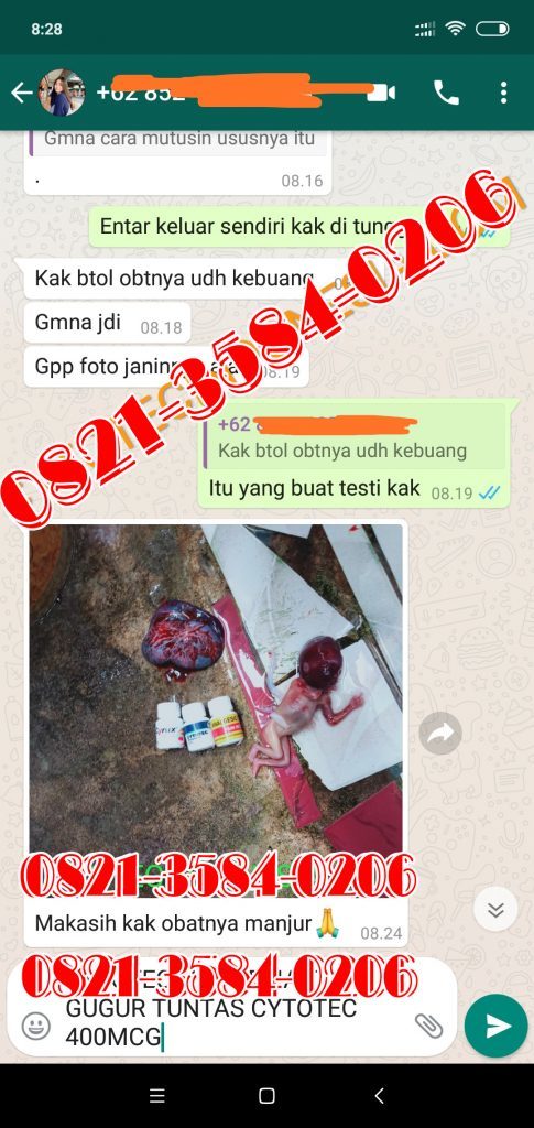 cara gugurkan kandungan 1 bulan